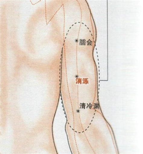 消爍穴|消泺